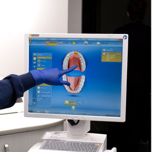 3D intraoral scanning provides faster and more accurate dental diagnosis.